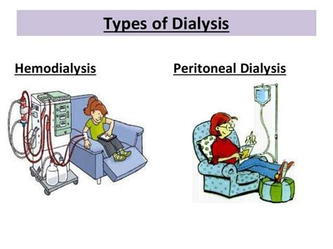 Dialysis Access Hemo Dialysis