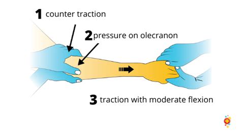 Elbow Dislocations Dont Forget The Bubbles