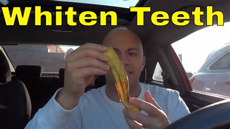 Inlays extend into the interdental areas of your mouth (between your teeth). How To Whiten Teeth With A Banana Peel-DIY - YouTube