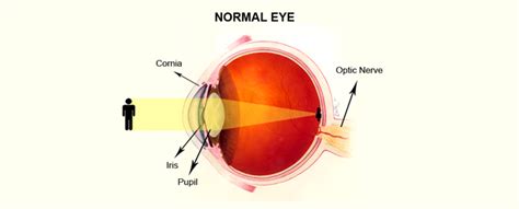 How The Eye Works Home Health Clinic