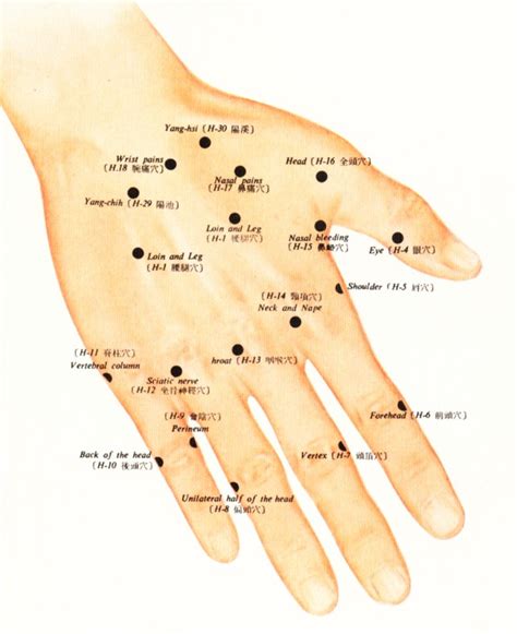 Acupuncture For Back Pain