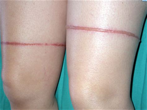 Scheda - Atlante Dermatologico