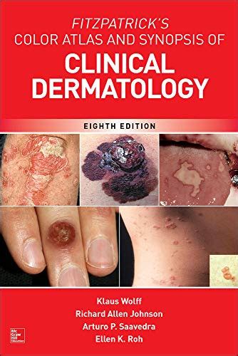 Physicians Best Dermatology Book For Primary Care Physicians