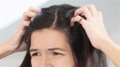 What Causes Itchy Bumps On Scalp And How You Can Get Rid Of Them