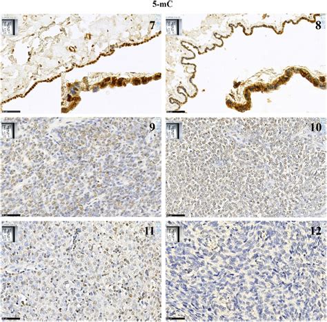 Continued C Representative Images Of Normal Mesothelial Cells Of