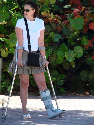 Pretty Girl On Crutches With A Broken Ankle Stock Photo And Royalty