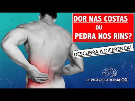 DESCUBRA a diferença entre Dor lombar e Pedra nos rins Dr Paolo Souto
