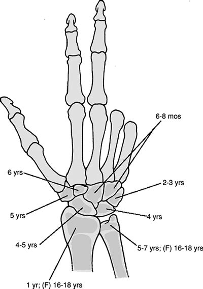 Pediatric Wrist And Hand Teachme Orthopedics
