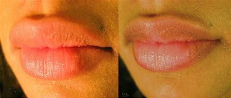 How To Lighten Dark Lips Fast Homemade Recipe Remedies For Dark