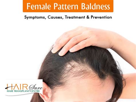 Female Pattern Baldness Symptoms Causes Treatment And Prevention