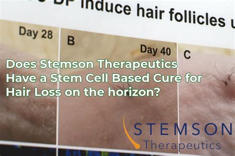 Stemson Therapeutics Clinical Trials As Planned In January 2021 An