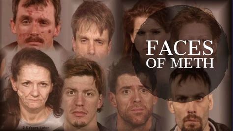 Photos How Methamphetamine Destroys Your Face And Physical Appearance