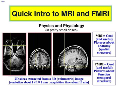 Ppt A F N I And Fmri Introduction Concepts Principles Powerpoint