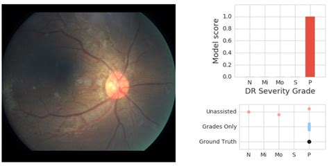 Improving The Effectiveness Of Diabetic Retinopathy Models