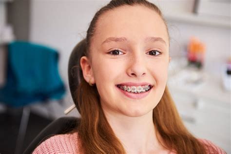 6 Things To Do Before Getting Braces Canley Heights Dental Care