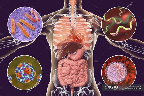 Digital Illustration Showing Bacteria Causing Infections Of Respiratory