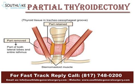The Thyroid Is A Small Sized Butterfly Shaped Gland Located In The