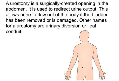 Urostomy