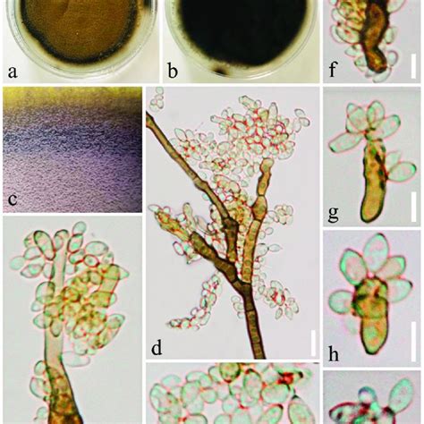 Cladosporium Anthropophilum Kumcc 19 0182 Ab Colony On Pda Media