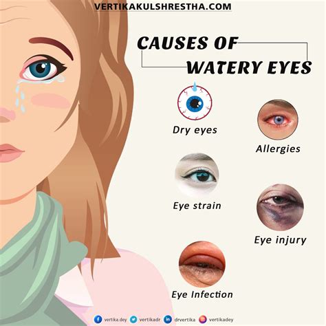 Causes Of Watery Eyes Dr Vertika Kulshrestha Eye Specialist