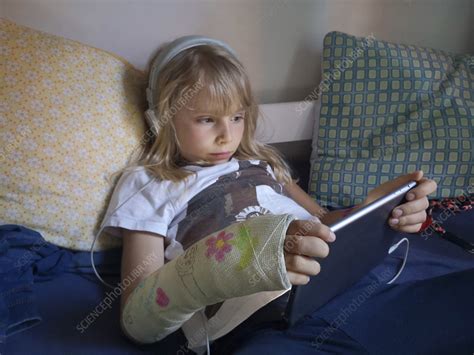 Girl With Broken Wrist In Cast Stock Image C0523270 Science Photo Library