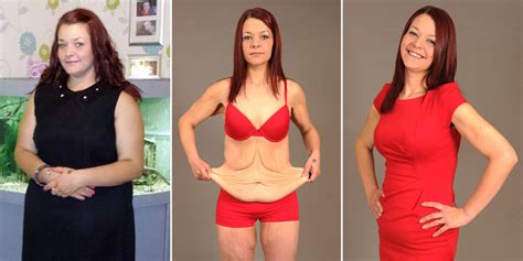 How To Stop Sagging Skin During Weight Loss WeightLossLook