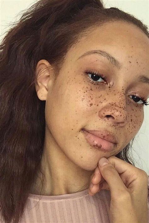 Beautiful Black Women Flaunting Their Freckles Artofit