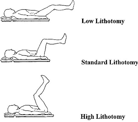Lithotomy position uses, types, lithotomy position complications
