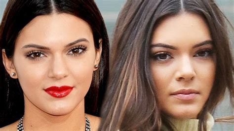 Kylie And Kendall Jenner Before And After