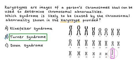 Question Video Identifying Turner Syndrome From A Karyotype Nagwa