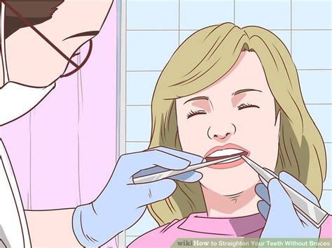How to fix crooked teeth without braces. How to Straighten Your Teeth Without Braces (with Pictures)