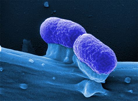 Escherichia coli (/ˌɛʃəˈrɪkiə ˈkoʊlaɪ/), also known as e. L'Échelle de Jacob: Bactérie E. coli : testée comme arme ...