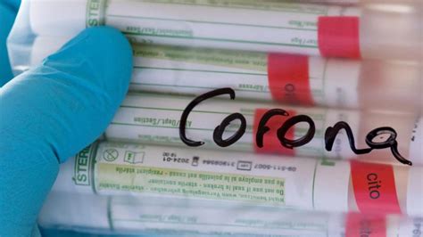Die lage in deutschland bleibt angespannt. Gesundheit: Corona-Inzidenz leicht gefallen: Weiter ...