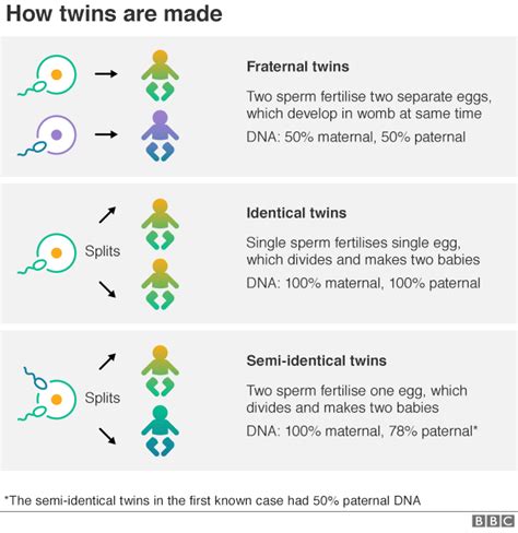 Semi Identical Twins Identified For Only The Second Time Bbc News