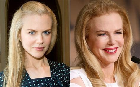 Nicole Kidman Pesa No Botox Mas Brilha Em Cannes Compare Quem