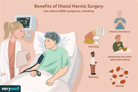 Hiatal Hernia Surgery Long Term Care