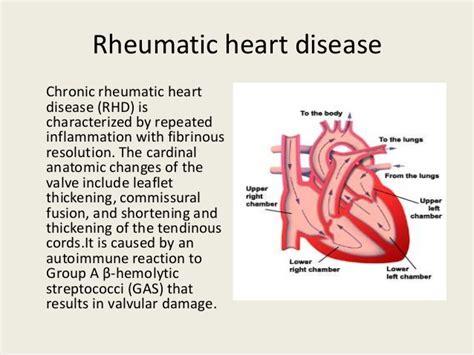 Rheumatic Fever