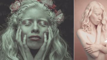 Albino Model Challenges Beauty Standards By Embracing Her Pale Skin And Silver Hair In A Series
