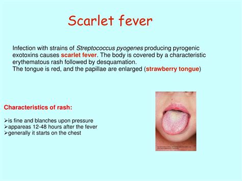 Ppt Basic Principles Of Infectious Diseases Powerpoint Presentation