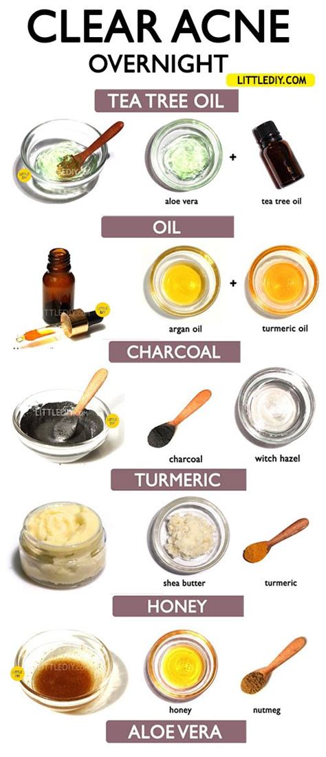 Top 6 Remedies To Clear Acne Overnight Little Diy Clear Acne