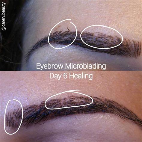 Microblading Scabbing Day By Day What To Expect