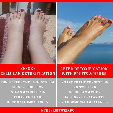 Reverse Edema Swelling Of The Feet Legs Face And Hands Thefruitweirdo