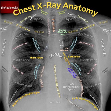 Prep for a quiz or learn for fun! Anatomy Of Chest X Ray - Anatomy Drawing Diagram
