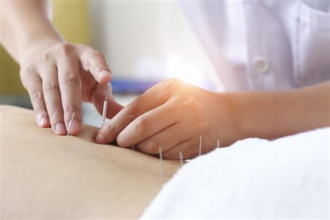 acupuncture everything you need to know before you try it cnet