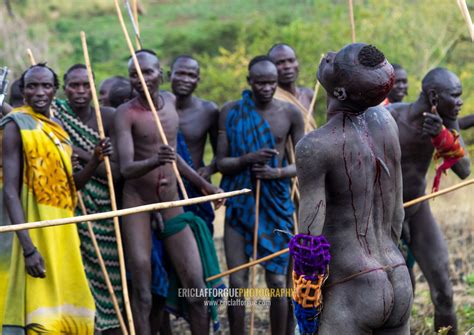 ERIC LAFFORGUE PHOTOGRAPHY Suri Tribe Warrior Bleeding During A Donga Stick Fighting Ritual
