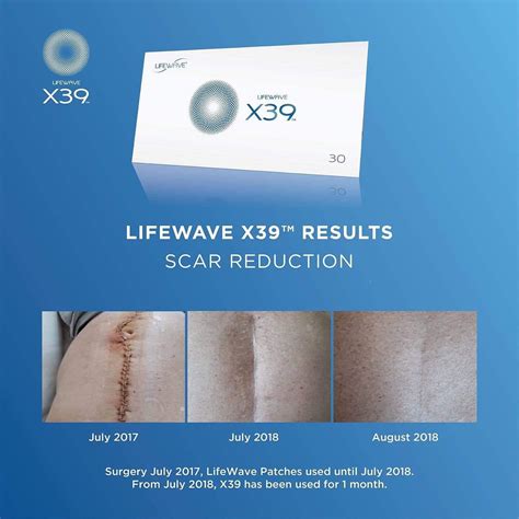 Lifewave X39™ Patches Activate Your Stem Cells Spark Of Life