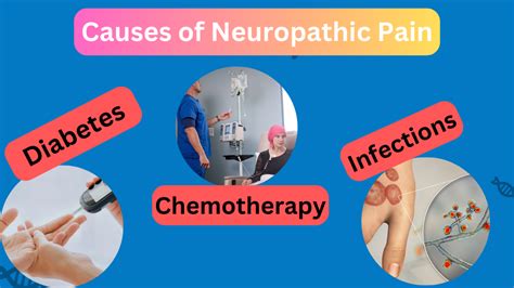 Neuropathic Pain Nerve Pain Feeling Signs Causes And Treatment