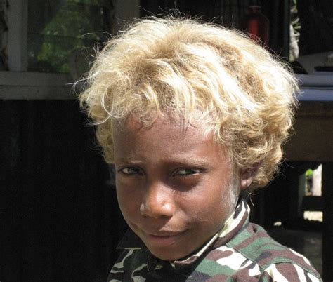 Another Genetic Quirk Of The Solomon Islands Blond Hair The New York