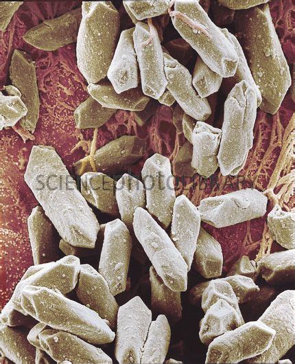 Otolith Crystals Balancing Stone From Inner Ear Sem Stock Image
