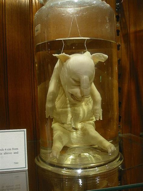 1000 Images About Mutter Museum Of Medical Oddities On Pinterest